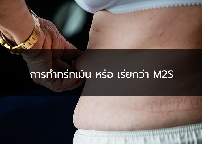 การทำทรีทเม้น หรือ เรียกว่า M2S